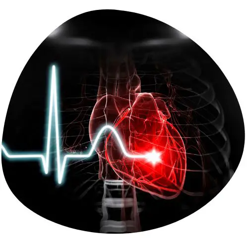 Irregular Heartbeat Caused By High Blood Pressure